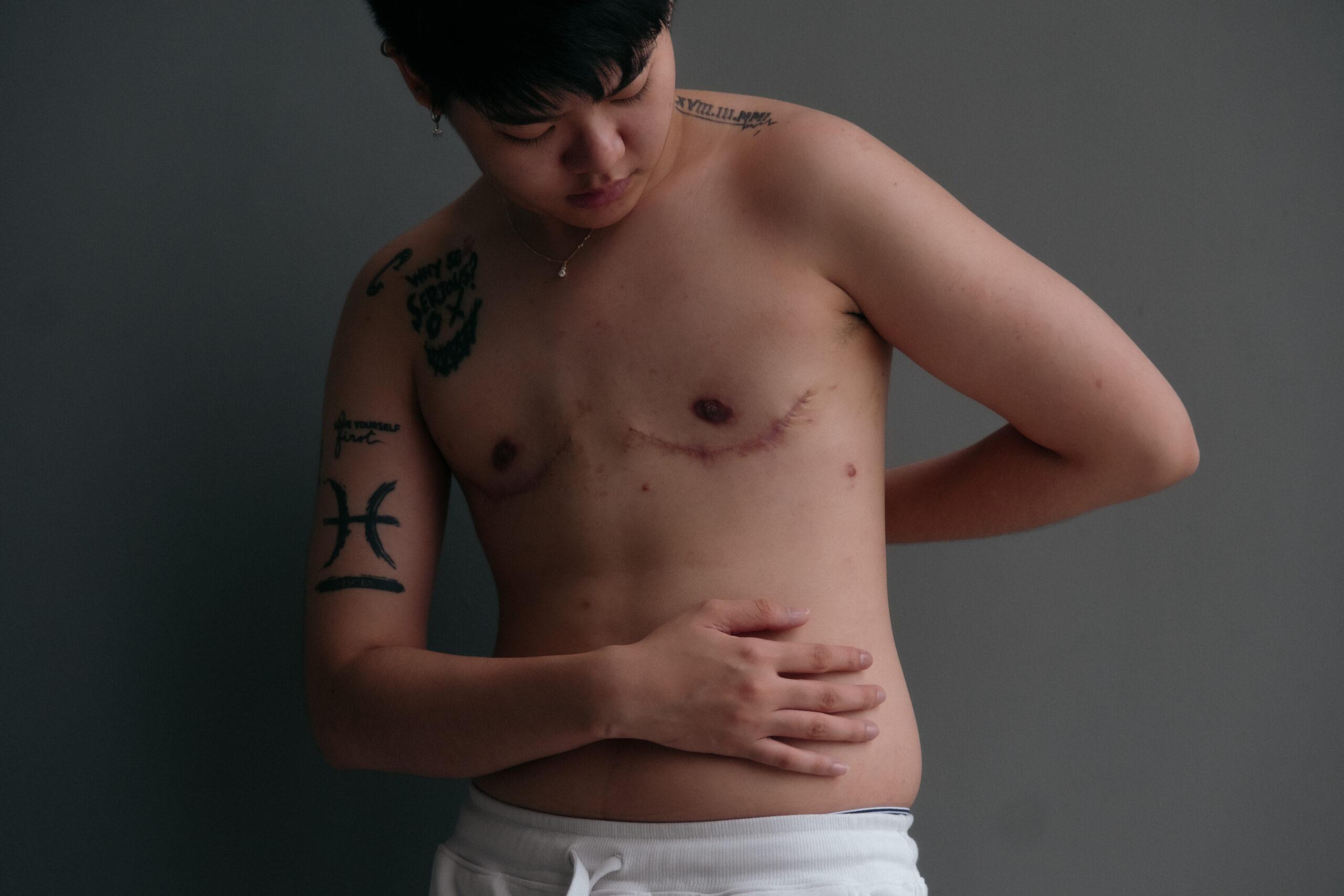 เรื่องราวใต้รอยมีด บาดแผล Gender X ที่ยังไม่สมาน