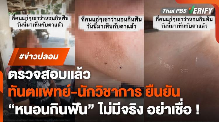 ตรวจสอบพบ : &#8220;ทันตแพทย์-นักวิชาการ&#8221; ยันชัด &#8220;หนอนกินฟัน&#8221; ไม่มีจริง !