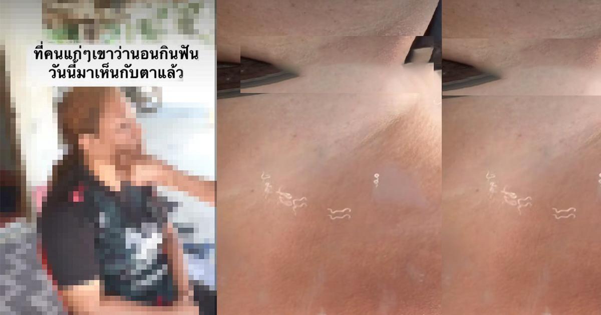 Verification : Dentists and Academics Confirm: “Tooth Worms” Do Not Exist!