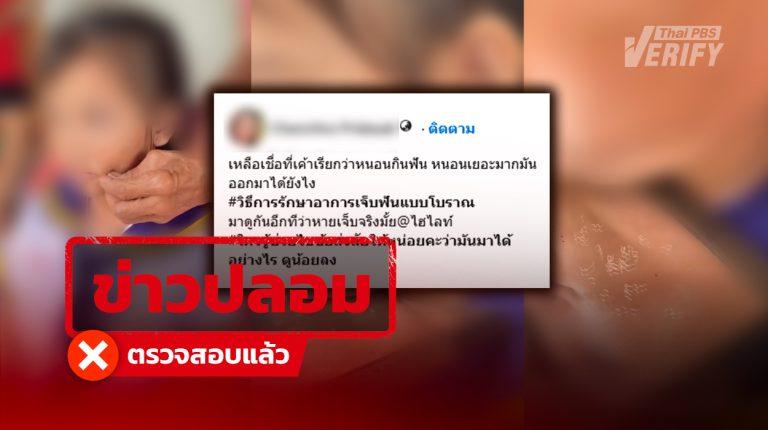 ไม่มีจริง ! Thai PBS Verify ตรวจสอบคลิปอ้าง หมอพื้นบ้านป้ายยาแก้ปวดฟัน ทำ "หนอนกินฟัน" หลุดออกกระพุ้งแก้ม