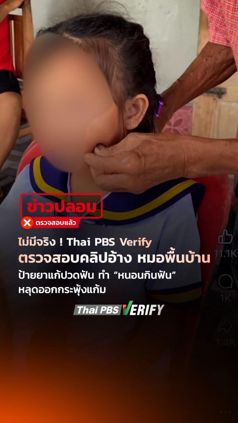 ไม่มีจริง ! Thai PBS Verify ตรวจสอบคลิปอ้าง หมอพื้นบ้านป้ายยาแก้ปวดฟัน ทำ “หนอนกินฟัน” หลุดออกกระพุ้งแก้ม : Thai PBS Verify